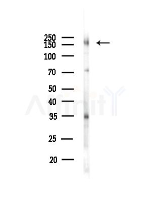 Phospho-NFAT5 (Ser134) Antibody - Western blot analysis of lysates from B16F10-LUC cells(starvation,24h treatment), using Phospho-NFAT5 (Ser134) Antibody at 1/1000 dilution.