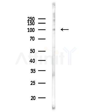 Phospho-KIF20A (Tyr869) Antibody - Western blot analysis of lysates from PC12 cells(UV,30min treatment), using Phospho-KIF20A (Tyr869) Antibody at 1/1000 dilution.