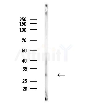 Phospho-PZR (Tyr241) Antibody - Western blot analysis of lysates from Mouse brain, using Phospho-PZR (Tyr241) Antibody at 1/1000 dilution.