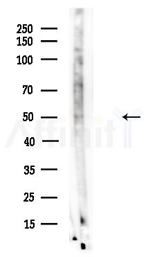 Phospho-OSR1 (Ser339) Antibody - Western blot analysis of lysates from A375 cells(LPS,4h treatment), using Phospho-OSR1 (Ser339) Antibody at 1/1000 dilution.