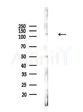 Phospho-LATS1 (Thr1079) Antibody - Western blot analysis of lysates from Hela cells(UV,30min treatment), using Phospho-LATS1 (Thr1079) Antibody at 1/1000 dilution.