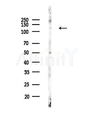 Phospho-LATS1 (Thr1079) Antibody - Western blot analysis of lysates from COLO205 cells(UV,30min treatment), using Phospho-LATS1 (Thr1079) Antibody at 1/1000 dilution.
