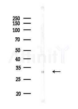 Phospho-IL-2RA/CD25 (Ser268) Antibody - Western blot analysis of lysates from HUVEC cells, using Phospho-IL-2RA/CD25 (Ser268) Antibody at 1/1000 dilution.
