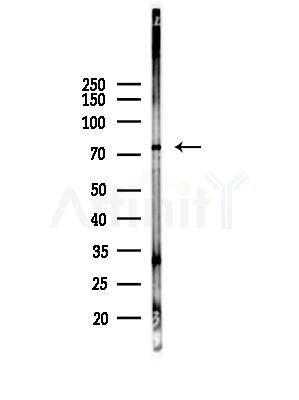 Phospho-Lamin A/C (Ser301) Antibody - Western blot analysis of lysates from B16F10-LUC cells(heat-shock,45min treatment), using Phospho-Lamin A/C (Ser301) Antibody at 1/1000 dilution.