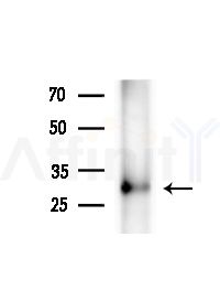 Phospho-Thymidine Kinase 1/TK1 (Tyr181) Antibody - Western blot analysis of lysates from B16F10-LUC cells(starvation,24h treatment), using Phospho-Thymidine Kinase 1/TK1 (Tyr181) Antibody at 1/1000 dilution.