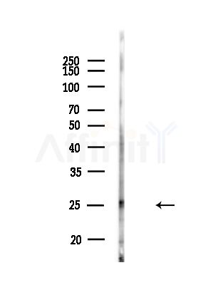 Phospho-Thymidine Kinase 1/TK1 (Tyr181) Antibody - Western blot analysis of lysates from B16F10-LUC cells(starvation,24h treatment), using Phospho-Thymidine Kinase 1/TK1 (Tyr181) Antibody at 1/1000 dilution.