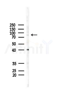 Phospho-TrkA (Tyr496) Antibody - Western blot analysis of lysates from 3T3-L1 cells(heat-shock,45min treatment), using Phospho-TrkA (Tyr496) Antibody at 1/1000 dilution.