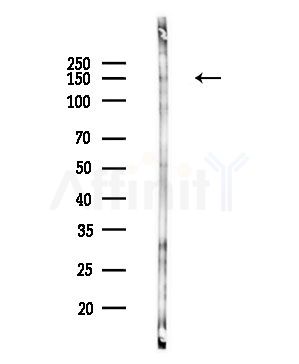 Phospho-APP (Tyr757) Antibody - Western blot analysis of lysates from COLO205 cells(UV,30min treatment), using Phospho-APP (Tyr757) Antibody at 1/1000 dilution.