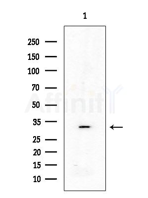 Phospho-eIF2 alpha (Tyr150) Antibody - Western blot analysis of lysates from Rat testis, using Phospho-eIF2 alpha (Tyr150) Antibody at 1/1000 dilution.
