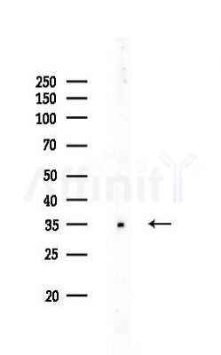 Phospho-eIF2 alpha (Tyr150) Antibody - Western blot analysis of lysates from Rat testis, using Phospho-eIF2 alpha (Tyr150) Antibody at 1/1000 dilution.
