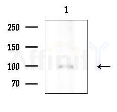 Phospho-ATP1A1 (Tyr542) Antibody - Western blot analysis of extracts from K562 cells(heat-shock treatment), using Phospho-ATP1A1 (Tyr542) Antibody at 1/1000 dilution.