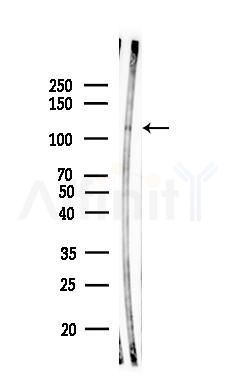 Phospho-ATP1A1 (Tyr542) Antibody - Western blot analysis of lysates from K562 cells(heat-shock,45min treatment), using Phospho-ATP1A1 (Tyr542) Antibody at 1/1000 dilution.