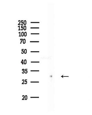 Phospho-eIF4E (Thr210) Antibody - Western blot analysis of lysates from COLO205 cells(heat-shock,45min treatment), using Phospho-eIF4E (Thr210) Antibody at 1/1000 dilution.
