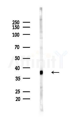 Phospho-Nucleophosmin (Ser10) Antibody - Western blot analysis of lysates from Hela cells(heat-shock,45min treatment), using Phospho-Nucleophosmin (Ser10) Antibody at 1/1000 dilution.