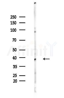 Phospho-Nucleophosmin (Ser10) Antibody - Western blot analysis of lysates from LoVo cells(heat-shock,45min treatment), using Phospho-Nucleophosmin (Ser10) Antibody at 1/1000 dilution.