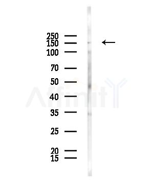 Phospho-MCSF Receptor (Tyr546) Antibody - Western blot analysis of lysates from HepG2 cells(starvation,24h treatment), using Phospho-MCSF Receptor (Tyr546) Antibody at 1/1000 dilution.