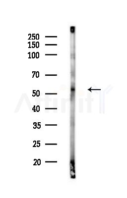 Phospho-Lyn (Tyr193) Antibody - Western blot analysis of lysates from A375 cells(starvation,24h treatment), using Phospho-Lyn (Tyr193) Antibody at 1/1000 dilution.
