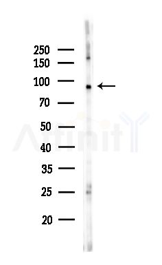 Phospho-IGF1 Receptor (Thr1163) Antibody - Western blot analysis of lysates from HepG2 cells(heat-shock,45min treatment), using Phospho-IGF1 Receptor (Thr1163) Antibody at 1/1000 dilution.