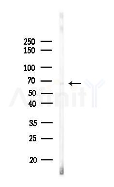 Phospho-A-RAF (Ser582) Antibody - Western blot analysis of lysates from K562 cells(heat-shock,45min treatment), using Phospho-A-RAF (Ser582) Antibody at 1/1000 dilution.