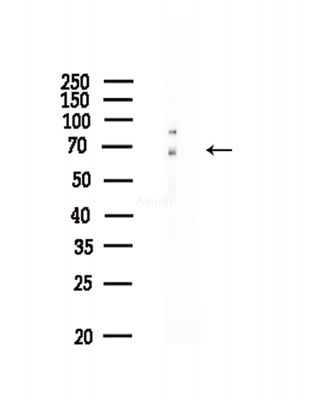 Phospho-A-RAF (Ser214) Antibody - Western blot analysis of lysates from COLO205 cells(heat-shock,45min treatment), using Phospho-A-RAF (Ser214) Antibody at 1/1000 dilution.