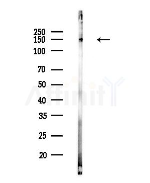 Phospho-Bcr (Tyr852) Antibody - Western blot analysis of lysates from COLO205 cells(UV,30min treatment), using Phospho-Bcr (Tyr852) Antibody at 1/1000 dilution.