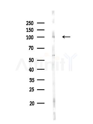 Phospho-EEF2 (Tyr443) Antibody - Western blot analysis of lysates from HUVEC cells, using Phospho-EEF2 (Tyr443) Antibody at 1/1000 dilution.
