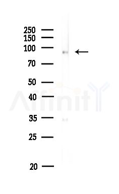 Phospho-EEF2 (Thr57) Antibody - Western blot analysis of lysates from MDA-MB-231 cells(heat-shock,45min treatment), using Phospho-EEF2 (Thr57) Antibody at 1/1000 dilution.