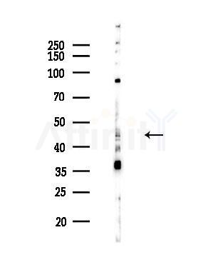 Phospho-NCF1/p47-phox (Ser304) Antibody - Western blot analysis of lysates from Hela cells(heat-shock,45min treatment), using Phospho-NCF1/p47-phox (Ser304) Antibody at 1/1000 dilution.