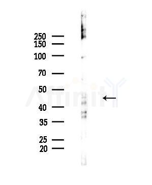 Phospho-NCF1/p47-phox (Ser304) Antibody - Western blot analysis of lysates from COLO205 cells(heat-shock,45min treatment), using Phospho-NCF1/p47-phox (Ser304) Antibody at 1/1000 dilution.