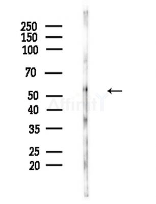Phospho-PKM2 (Tyr370) Antibody - Western blot analysis of lysates from Hela cells(LPS,4h treatment), using Phospho-PKM2 (Tyr370) Antibody at 1/1000 dilution.