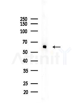 Phospho-PKM2 (Ser37) Antibody - Western blot analysis of lysates from EC304 cells, using Phospho-PKM2 (Ser37) Antibody at 1/1000 dilution.