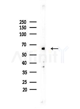 Phospho-PKM2 (Ser37) Antibody - Western blot analysis of lysates from COLO205 cells, using Phospho-PKM2 (Ser37) Antibody at 1/1000 dilution.