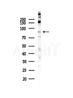 Phospho-B Raf (Ser729) Antibody - Western blot analysis of lysates from HepG2 cells(starvation,24h treatment), using Phospho-B Raf (Ser729) Antibody at 1/1000 dilution.
