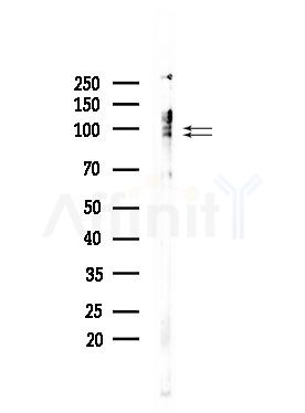 Phospho-IFNGR1 (Tyr457) Antibody - Western blot analysis of lysates from COLO205 cells, using Phospho-IFNGR1 (Tyr457) Antibody at 1/1000 dilution.