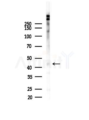 Phospho-FRA1 (Thr227) Antibody - Western blot analysis of lysates from 293 cells(LPS,4h treatment), using Phospho-FRA1 (Thr227) Antibody at 1/1000 dilution.