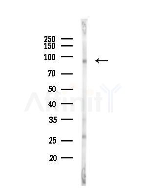 Phospho-FER (Tyr497) Antibody - Western blot analysis of lysates from EC304 cells(heat-shock,45min treatment), using Phospho-FER (Tyr497) Antibody at 1/1000 dilution.