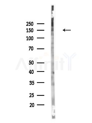 Phospho-PLCG2 (Tyr1245) Antibody - Western blot analysis of lysates from HUVEC cells, using Phospho-PLCG2 (Tyr1245) Antibody at 1/1000 dilution.