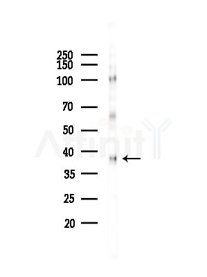 Phospho-JunB (Thr255) Antibody - Western blot analysis of lysates from HepG2 cells(starvation,24h treatment), using Phospho-JunB (Thr255) Antibody at 1/1000 dilution.
