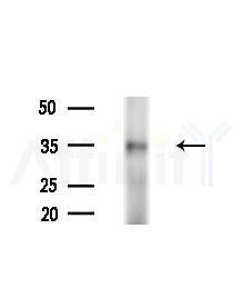 Phospho-JunD (Ser259) Antibody - Western blot analysis of extracts from EC304 cells(heat-shock,45min treatment), using Phospho-JunD (Ser259) Antibody at 1/1000 dilution.