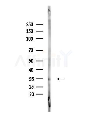 Phospho-JunD (Ser259) Antibody - Western blot analysis of lysates from EC304 cells(heat-shock,45min treatment), using Phospho-JunD (Ser259) Antibody at 1/1000 dilution.