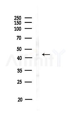 Phospho-PKA alpha/beta/gamma CAT (Thr198) Antibody - Western blot analysis of lysates from MDA-MB-231 cells(heat-shock,45min treatment), using Phospho-PKA alpha/beta/gamma CAT (Thr198) Antibody at 1/1000 dilution.