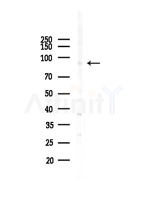 Phospho-PTP  alpha (Tyr271) Antibody - Western blot analysis of lysates from HepG2 cells(starvation,24h treatment), using Phospho-PTP  alpha (Tyr271) Antibody at 1/1000 dilution.