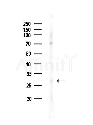 Phospho-ATF1 (Ser198) Antibody - Western blot analysis of lysates from COLO205 cells(heat-shock,45min treatment), using Phospho-ATF1 (Ser198) Antibody at 1/1000 dilution.