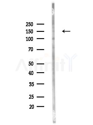 Phospho-PLCG1 (Tyr977) Antibody - Western blot analysis of lysates from HUVEC cells, using Phospho-PLCG1 (Tyr977) Antibody at 1/1000 dilution.