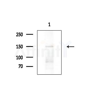 Phospho-PLCG1 (Tyr472) Antibody - Western blot analysis of lysates from Mouse brain, using Phospho-PLCG1 (Tyr472) Antibody at 1/1000 dilution.