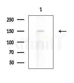 Phospho-PLCG1 (Tyr472) Antibody - Western blot analysis of lysates from Rat lung, using Phospho-PLCG1 (Tyr472) Antibody at 1/1000 dilution.