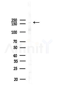 Phospho-PLCG1 (Tyr472) Antibody - Western blot analysis of lysates from Rat lung, using Phospho-PLCG1 (Tyr472) Antibody at 1/1000 dilution.