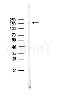 Phospho-PLCG1 (Tyr472) Antibody - Western blot analysis of lysates from Mouse brain, using Phospho-PLCG1 (Tyr472) Antibody at 1/1000 dilution.