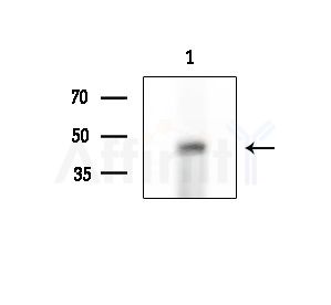 Phospho-BCL-3 (Ser41) Antibody - Western blot analysis of extracts from 293 cells(LPS 4h treatment), using Phospho-BCL-3 (Ser41) Antibody at 1/1000 dilution.