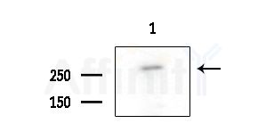 Phospho-Filamin A (Tyr1604) Antibody - Western blot analysis of extracts from COLO205 cells, using Phospho-Filamin A (Tyr1604) Antibody at 1/1000 dilution.